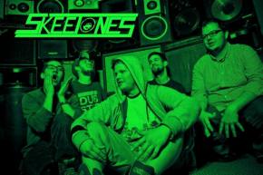 Skeetones Release Free Rarities and Remixes Album Preview